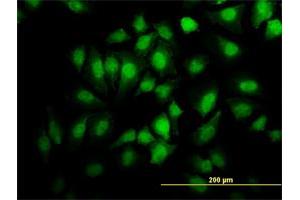 Immunofluorescence of monoclonal antibody to EHD2 on HeLa cell. (EHD2 抗体  (AA 365-427))
