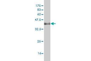 Western Blot detection against Immunogen (38. (DLX2 抗体  (AA 1-110))