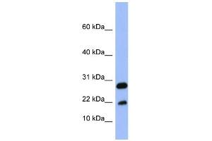 WB Suggested Anti-FABP4 Antibody Titration:  0. (FABP4 抗体  (Middle Region))
