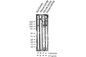 Western blot analysis of Phospho-FAK (Tyr925) expression in various lysates (FAK 抗体  (pTyr925))
