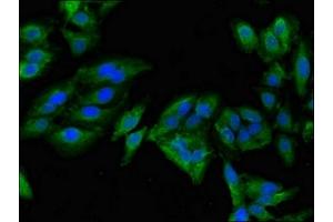 Immunofluorescent analysis of Hela cells using ABIN7143899 at dilution of 1:100 and Alexa Fluor 488-congugated AffiniPure Goat Anti-Rabbit IgG(H+L) (alpha-Mannosidase II 抗体  (AA 31-181))