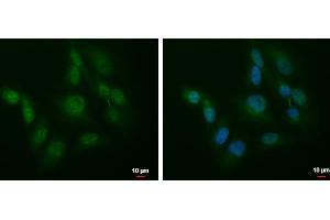 ICC/IF Image SLU7 antibody detects SLU7 protein at cytoplasm and nucleus by immunofluorescent analysis. (SLU7 抗体  (C-Term))
