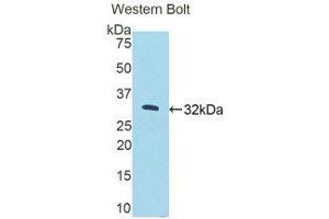 Western Blotting (WB) image for anti-Protein Kinase N2 (PKN2) (AA 67-312) antibody (ABIN1175309) (PKN2 抗体  (AA 67-312))