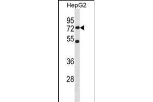 SETD3 Antibody (C-term) (ABIN1881794 and ABIN2838755) western blot analysis in HepG2 cell line lysates (35 μg/lane). (SETD3 抗体  (C-Term))