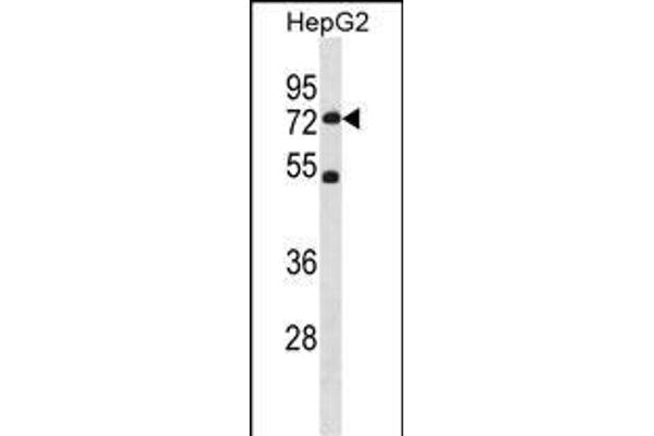 SETD3 Antikörper  (C-Term)
