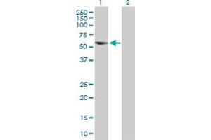 Western Blot analysis of C17orf57 expression in transfected 293T cell line by C17orf57 MaxPab polyclonal antibody. (C17orf57 抗体  (AA 1-531))