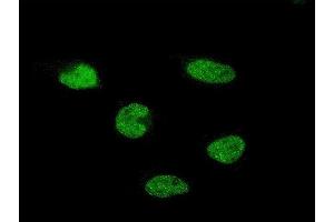 Immunofluorescence of monoclonal antibody to C11orf30 on HeLa cell. (EMSY 抗体  (AA 1081-1178))