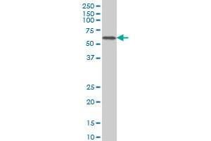 CACNB2 monoclonal antibody (M01), clone 6C1 Western Blot analysis of CACNB2 expression in Jurkat . (CACNB2 抗体  (AA 213-301))