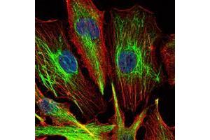 Immunofluorescence analysis of U251 cells using KLHL22 mouse mAb (green). (KLHL22 抗体)