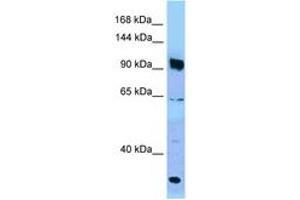 Image no. 1 for anti-PARG (PARG) (AA 770-819) antibody (ABIN6748252) (PARG 抗体  (AA 770-819))