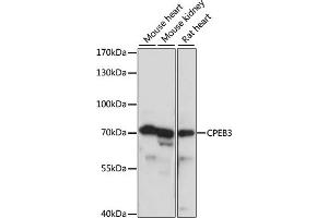 Western blot analysis of extracts of various cell lines, using CPEB3 antibody (ABIN7266666) at 1:1000 dilution. (CPEB3 抗体  (AA 150-400))