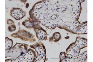 Immunoperoxidase of monoclonal antibody to ADPRH on formalin-fixed paraffin-embedded human placenta. (ADPRH 抗体  (AA 23-121))