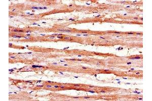 Immunohistochemistry of paraffin-embedded human heart tissue using ABIN7168345 at dilution of 1:100 (RBM4 抗体  (AA 121-205))