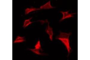 Immunofluorescence (fixed cells) (IF/ICC) image for anti-Potassium Inwardly-Rectifying Channel, Subfamily J, Member 4 (KCNJ4) (Internal Region) antibody (ABIN6257761)