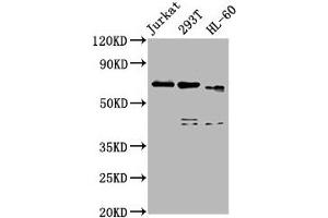Western Blot Positive WB detected in: Jurkat whole cell lysate, 293T whole cell lysate, HL60 whole cell lysate All lanes: CBFA2T3 antibody at 5 μg/mL Secondary Goat polyclonal to rabbit IgG at 1/50000 dilution Predicted band size: 72, 63, 64, 8 kDa Observed band size: 72 kDa