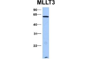 Host:  Rabbit  Target Name:  MLLT3  Sample Type:  Hela  Antibody Dilution:  1. (AF9 抗体  (N-Term))