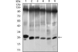 TWIST1 抗体  (AA 9-74)