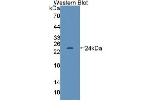 Western Blotting (WB) image for anti-Acyl-CoA Dehydrogenase, C-2 To C-3 Short Chain (Acads) (AA 210-397) antibody (ABIN5013074)