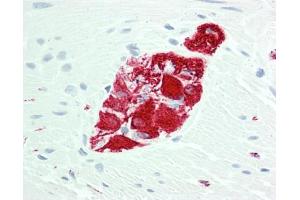 Human Colon, Myenteric Plexus: Formalin-Fixed, Paraffin-Embedded (FFPE)