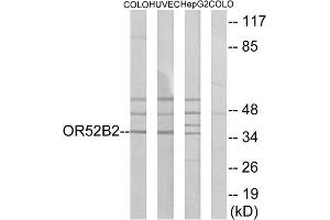 Western blot analysis of extracts from COLO cells, HUVEC cells and HepG2 cells, using OR52B2 antibody. (OR52B2 抗体  (Internal Region))