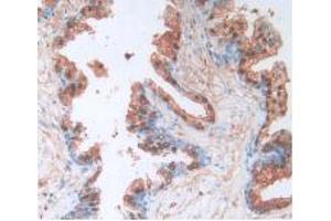 IHC-P analysis of Human Prostate Gland Tissue, with DAB staining. (Caspase 4 抗体  (AA 944-1148))