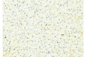 ABIN6275010 at 1/100 staining Mouse liver tissue by IHC-P. (CHSY1 抗体  (Internal Region))