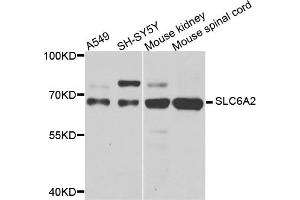 Western blot analysis of extracts of various cell lines, using SLC6A2 antibody (ABIN5974706) at 1/1000 dilution. (SLC6A2 抗体)