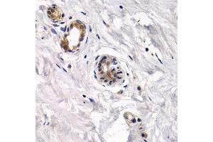 Immunohistochemistry of paraffin-embedded human normal breast using CAPN3 antibody at dilution of 1:200 (400x lens). (Calpain 3 抗体)