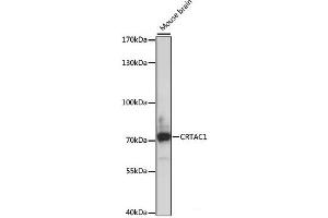 Western blot analysis of extracts of Mouse brain using CRTAC1 Polyclonal Antibody at dilution of 1:1000. (CRTAC1 抗体)
