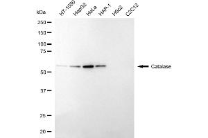 Western blotting analysis using catalase antibody (ABIN7797920). (Recombinant Catalase 抗体)