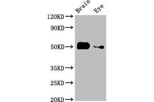 Western Blot Positive WB detected in: Zebrafish brain tissue, Zebrafish eye tissue All lanes: tuba8l2 antibody at 3 μg/mL Secondary Goat polyclonal to rabbit IgG at 1/50000 dilution Predicted band size: 51 kDa Observed band size: 51 kDa (tuba8l2 抗体  (AA 1-449))