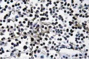 Immunohistochemistry (IHC) analyzes of PI 3-kinase p110alpha antibody in paraffin-embedded human lymph node tissue. (PIK3CA 抗体)