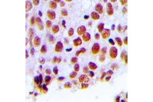 Immunohistochemistry (IHC) image for anti-Mismatch Repair Protein 2 (MSH2) antibody (ABIN7303176)