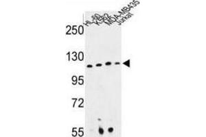 Western Blotting (WB) image for anti-Retinitis Pigmentosa GTPase Regulator Interacting Protein 1 (RPGRIP1) antibody (ABIN3003942) (RPGRIP1 抗体)