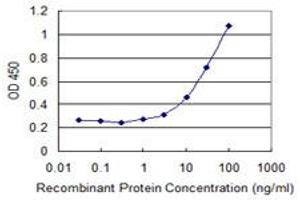 Detection limit for recombinant GST tagged VIL1 is 0. (Villin 1 抗体  (AA 1-421))