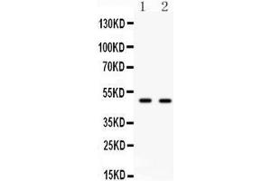 Anti- E2F3 antibody, Western blotting All lanes: Anti E2F3  at 0. (E2F3 抗体  (C-Term))