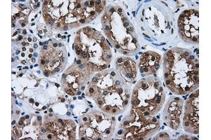 Immunohistochemical staining of paraffin-embedded liver tissue using anti-HDAC10mouse monoclonal antibody. (HDAC10 抗体)