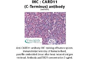 Image no. 1 for anti-Caspase Recruitment Domain Family, Member 11 (CARD11) (C-Term) antibody (ABIN1732635) (CARD11 抗体  (C-Term))
