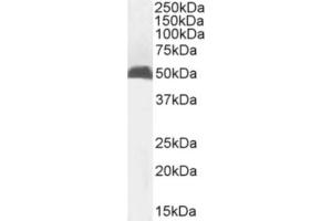 Western Blot using anti-MHC I antibody R1-21. (Recombinant MHC, Class I 抗体)