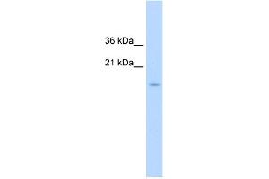 WB Suggested Anti-CENPA Antibody Titration:  1. (CENPA 抗体  (N-Term))