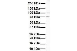 WB Suggested Anti-ITGB8 antibody Titration: 1 ug/mL Sample Type: Human Raji (ITGB8 抗体  (C-Term))