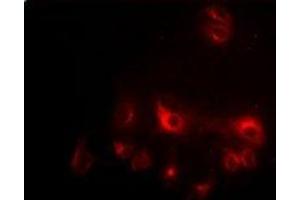 Immunofluorescent analysis of CCAR1 staining in HepG2 cells. (CCAR1 抗体)