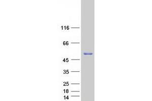 Western Blotting (WB) image for Protein Interacting With Protein Kinase C, alpha 1 (PICK1) (Transcript Variant 2) protein (Myc-DYKDDDDK Tag) (ABIN2728887)