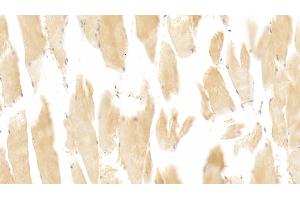 Immunohistochemistry (IHC) image for anti-Nitric Oxide Synthase 2, Inducible (NOS2) (AA 533-696) antibody (ABIN7428719)