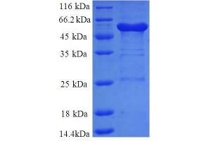 SDS-PAGE (SDS) image for Annexin A6 (ANXA6) (AA 2-245), (partial) protein (GST tag) (ABIN1095478)