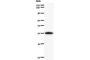 Western Blotting (WB) image for anti-Putative Homeodomain Transcription Factor 1 (PHTF1) antibody (ABIN930953)