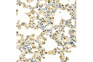Immunohistochemistry analysis of paraffin embedded mouse lung using contactin-1 (ABIN7073572) at dilution of 1: 300 (Contactin 1 抗体)