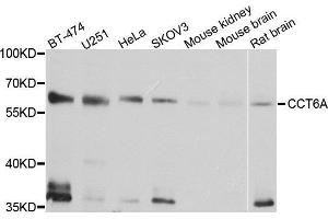 Western Blotting (WB) image for anti-Chaperonin Containing TCP1, Subunit 6A (Zeta 1) (CCT6A) (AA 80-250) antibody (ABIN1679063) (CCT6A 抗体  (AA 80-250))