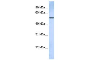 TRIM43 antibody used at 1 ug/ml to detect target protein. (TRIM43 抗体  (C-Term))