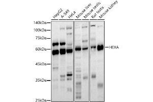 Western blot analysis of extracts of various cell lines, using HEXA antibody (ABIN6127520, ABIN6141731, ABIN6141733 and ABIN6221286) at 1:1000 dilution. (Hexosaminidase A 抗体  (AA 270-529))